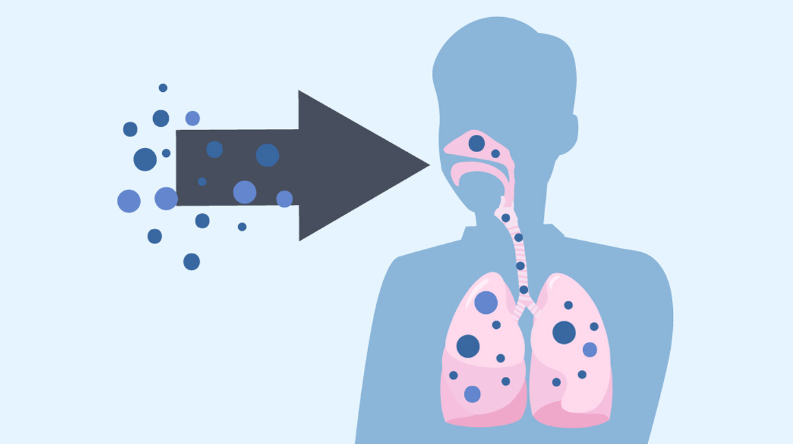 Identification of Mucormycosis patients- Early signs and symptoms