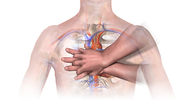 Chest Compression (Adults)