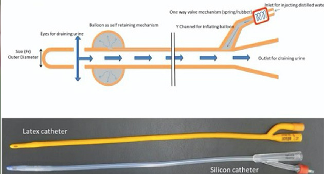 Urethral Catheterisation