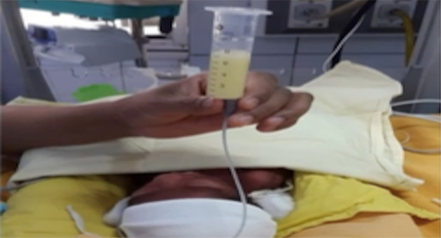 Neonatal OG Tube Feeding