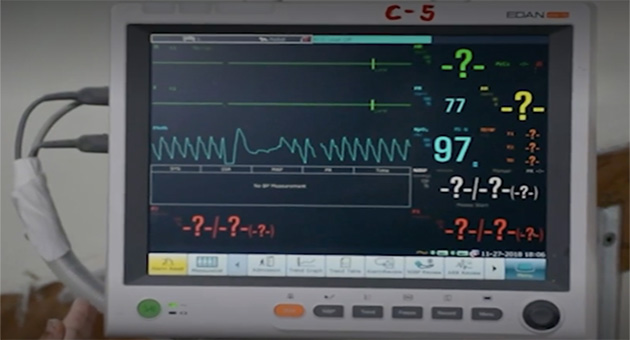 Pulse Oximetry