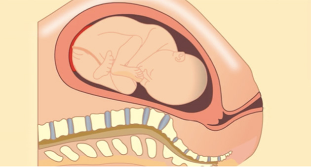 Normal Vaginal Delivery