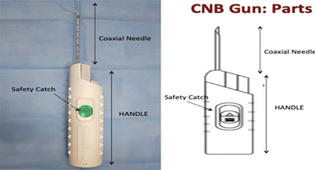 Core Needle Biopsy