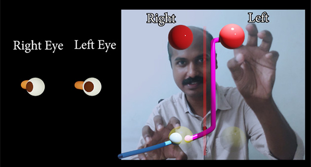 Neuroanatomy of Lateral Gaze