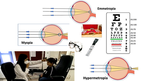 Refractive Error and Presbyopia