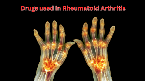 Drugs Used in Rheumatoid Arthritis