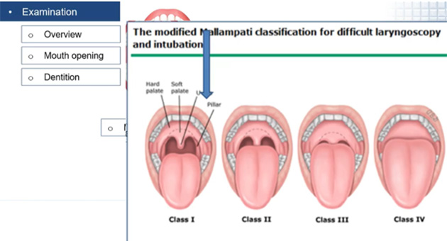 Pre-operative evaluation and concerns before anaesthesia 