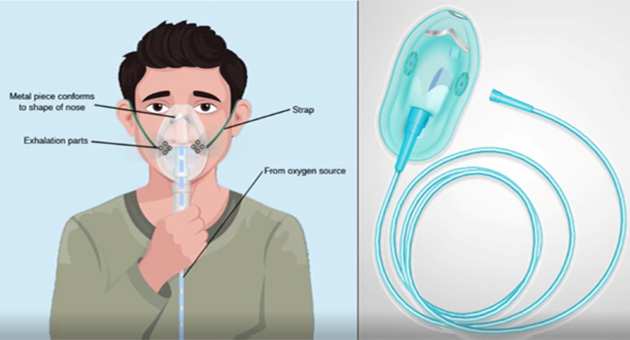 Post Anaesthesia Care Indications And Techniques Of Oxygen Therapy 