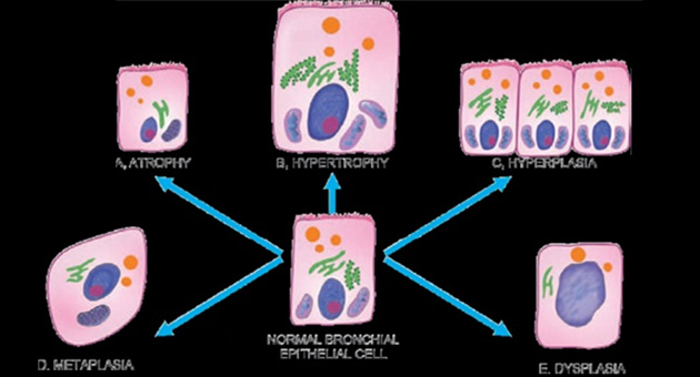 Cellular Adaptations