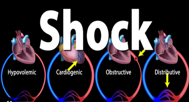 Approach to Shock