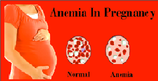 Anaemia In Pregnancy