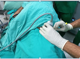 Regional Anesthesia