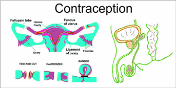 Contraception