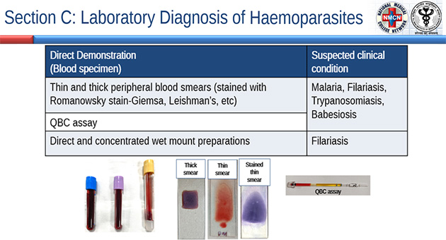 Laboratory Diagnosis of Parasitic Infections