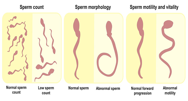 SEMEN & SPERM