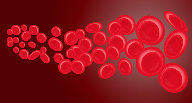 Post-Partum Haemorrhage : Surgical Management