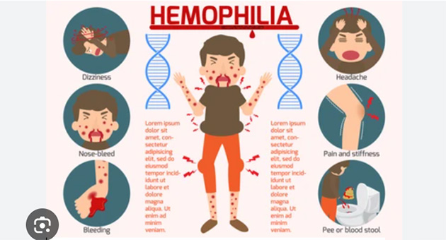 Evolution Of Hemophilia Care