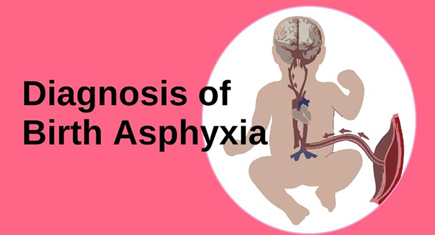 Diagnosis of Birth Asphyxia