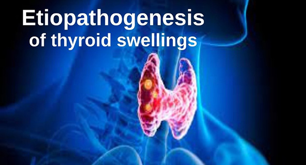 Etiopathogenesis of Thyroid Swellings