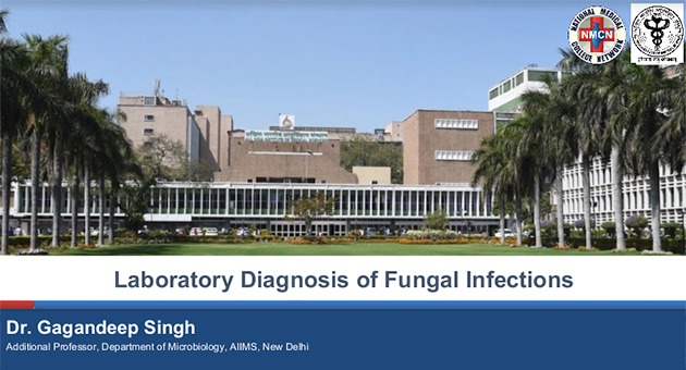 Laboratory diagnosis of fungal infections 