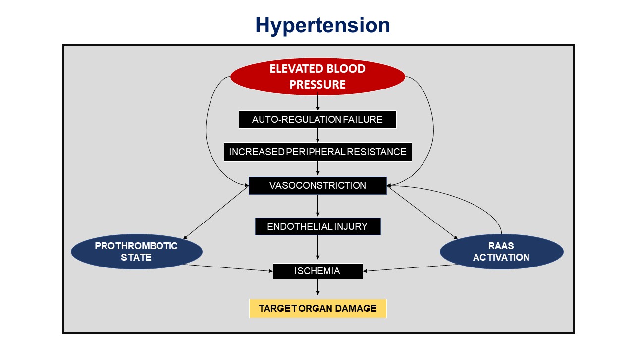 Hypertension