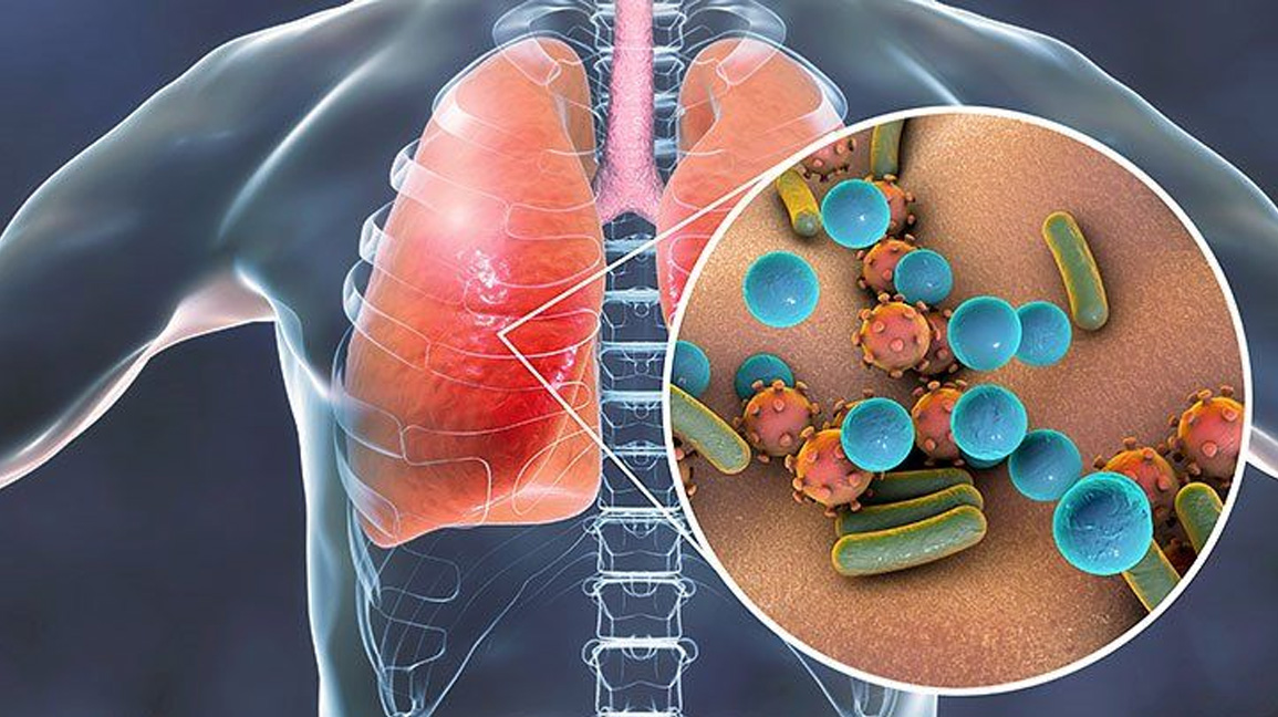 Introduction to Tuberculosis