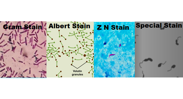 Bacterial Staining