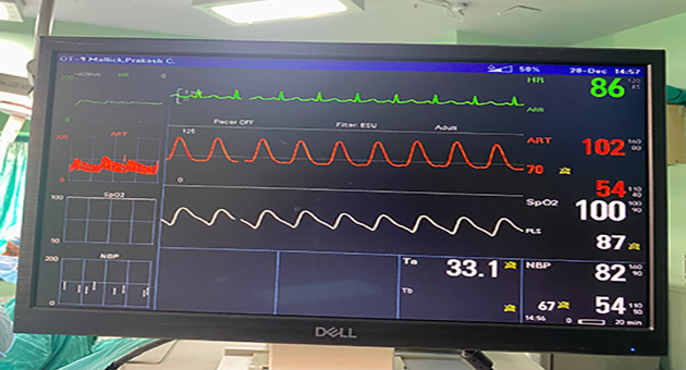 Intraoperative Anaesthesia Management