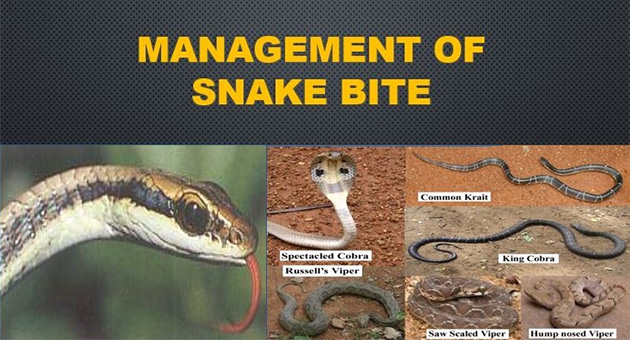 Management of Snake Bite