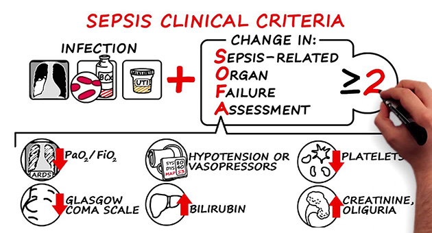 Sepsis: Diagnosis and Management