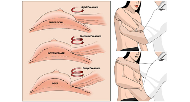 Clinical Assessment of Breast Lump