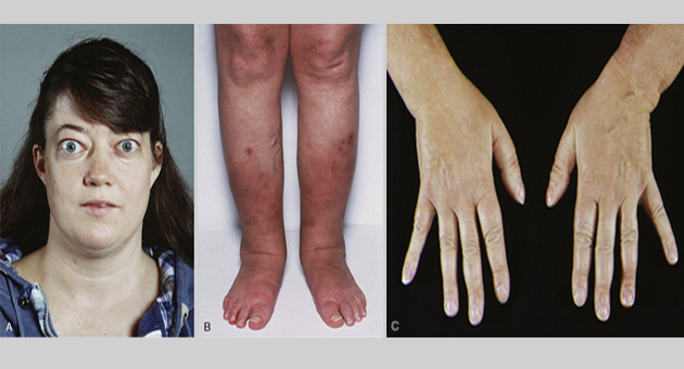 Systemic Diseases and Skin